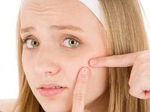 acne-mild-to-moderate acne-mild-to-moderate