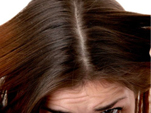 dandruff-treatment dandruff-treatment
